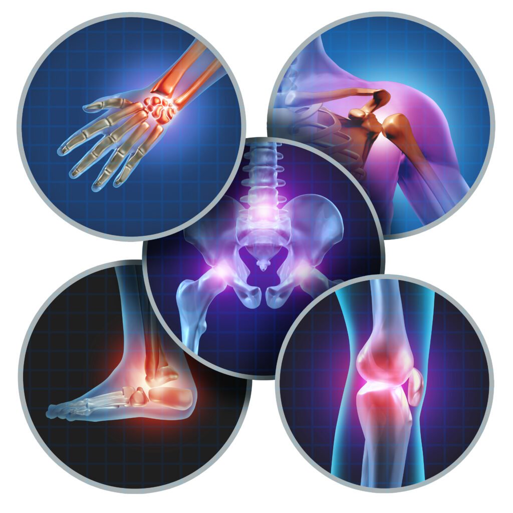 Human,Painful,Joints,Concept,With,The,Skeleton,Anatomy,Of,The